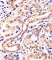 KCTD11 Antibody (N-Term)