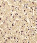 PGM1 Antibody (Center)