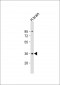 PLK5 Antibody (Center)