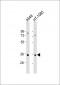 RSPO3 Antibody (C-Term)