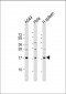 PLA2G2A Antibody (C-Term)