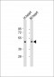 TPRA1 Antibody (N-Term)