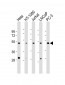 CERS4 Antibody (N-Term)