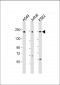 PSME4 Antibody (N-Term)