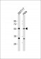 AAAS Antibody (C-Term)