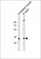 TPM3 Antibody (C-Term)