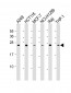 TPD52 Antibody (C-Term)