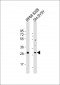 PPAPDC1B Antibody (Center)
