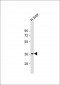 CTBS Antibody (N-Term)