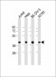 GBGT1 Antibody (Center)