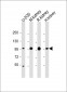 ACO1 Antibody (N-Term)