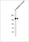 AGL Antibody (C-term)