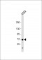 MCAM Antibody (Center)