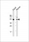 LSP1 Antibody (Center)