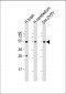 TUBB3 Antibody (N-term)