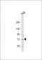 KLHL6 Antibody  (C-term)