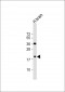 SNCB Antibody (C-term)