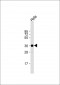 ARPC1A Antibody (C-term)