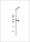 ELOVL6 Antibody (N-term)