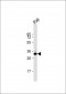 VDAC1 Antibody (N-term)