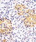 Hsp 60 Antibody (N-term)