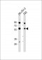 PAX8 Antibody (Center)