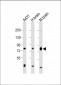 PKC beta1/2 Antibody (Center)