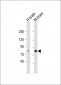 PKC beta1/2 Antibody (Center)