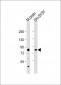 PKC beta1/2 Antibody (Center)