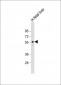 ACVR2A Antibody (N-term)