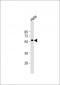 MNK2 (MKNK2) Antibody (C-term)