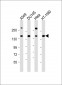 COL4A1 Antibody (N-term)
