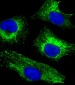 CYK18 Antibody (C-term)