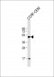 MYCN Antibody (C-term)