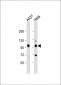 IGF1 Receptor (IGF1R) Antibody (C-term)