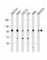 IGF1 Receptor (IGF1R) Antibody (C-term)