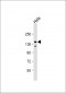 IRS2 Antibody (C-term)