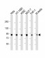 TBK1 Antibody (S172)