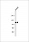 PIK3CG Antibody (C-term)