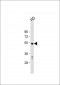 DUSP10 Antibody (N-term)