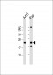 PSMB9 Antibody (C-term)