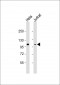 RB1 Antibody (C-term)