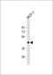 ADIPOR1 Antibody (C-term)