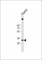 C1QTNF6 Antibody (N-term)