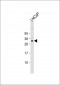 NKX3-1 Antibody (Center)