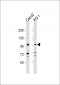 CSF3R Antibody (Center)