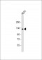 KIF11 Antibody (N-term)