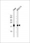 RPL18A Antibody (C-term)