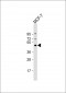 EIF4A2 Antibody (C-term)