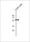 SLC22A6 Antibody (C-Term)